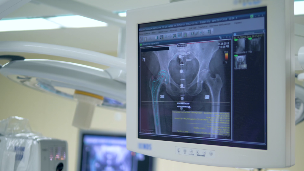 Новые методы и технологии в лечении коленного сустава