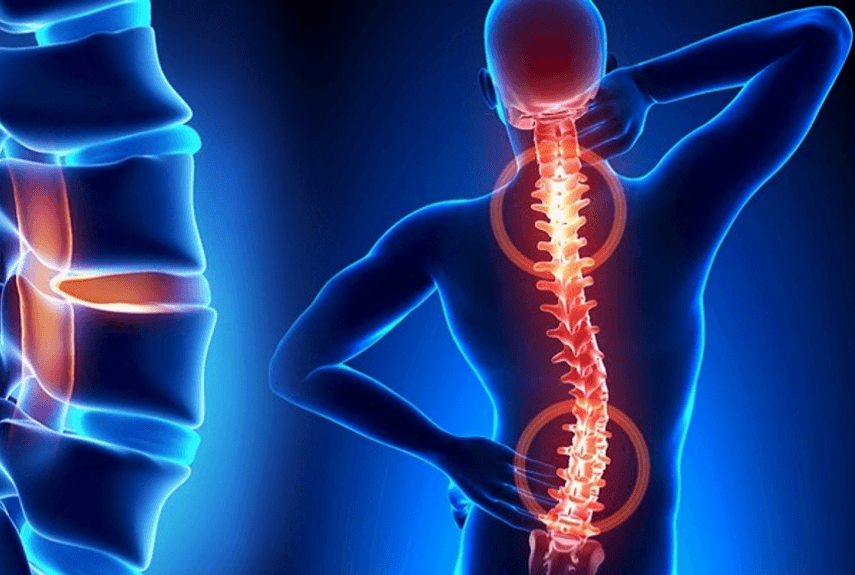 Наиболее частые причины мышечного спазма, который может вызывать боль в спине